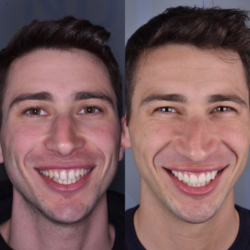 prima-e-dopo-dario-3