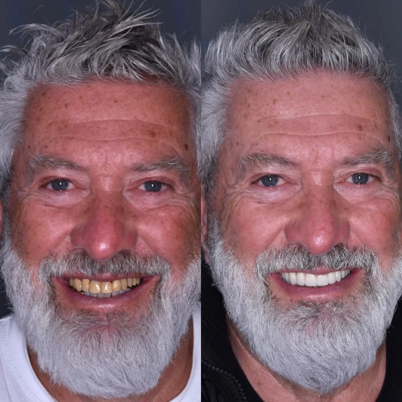 prima-e-dopo-roberto-1